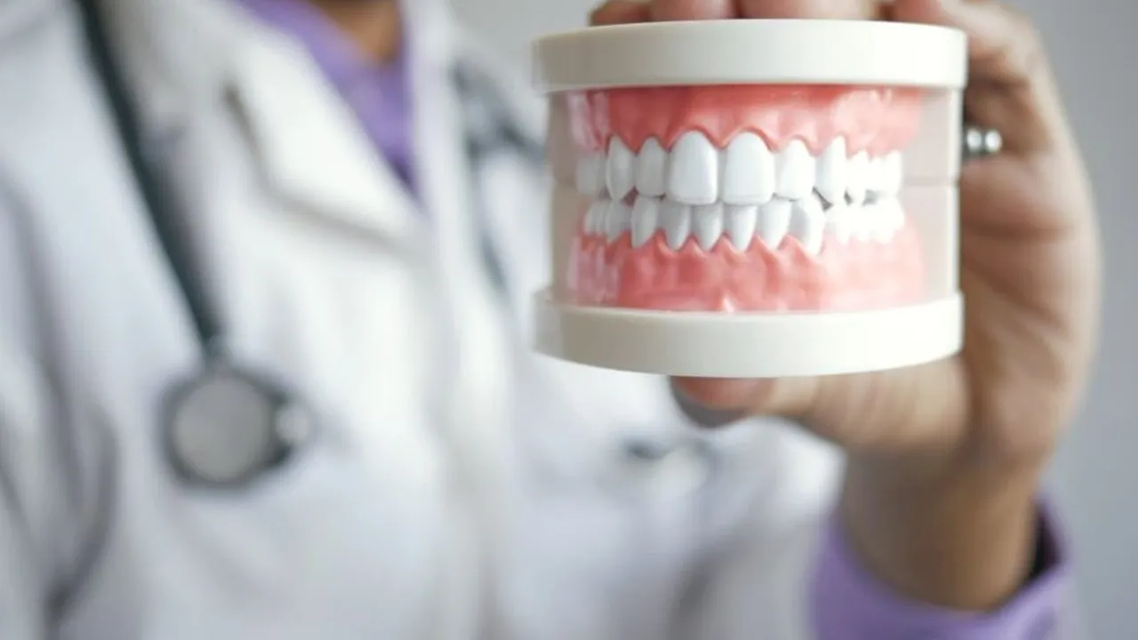 Bridge dentaire fixe prenant appui sur les dents voisines pour remplacer une dent manquante